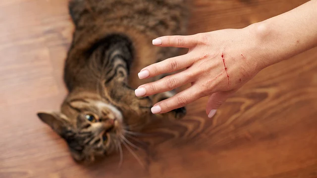 注意!“猫抓病”……淋巴结肿大和发烧。免疫系统较弱的人可能会 注意!“猫抓病”……淋巴结肿大和发烧。免疫系统较弱的人可能会