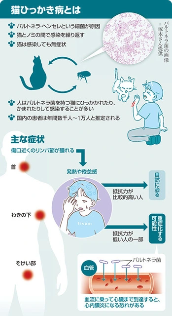 注意!“猫抓病”……淋巴结肿大和发烧。免疫系统较弱的人可能会 注意!“猫抓病”……淋巴结肿大和发烧。免疫系统较弱的人可能会